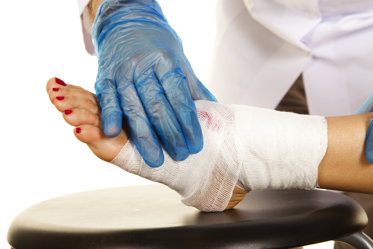 Orthopedic Treatment for Diabetic Foot Ulcers: A Comprehensive Guide