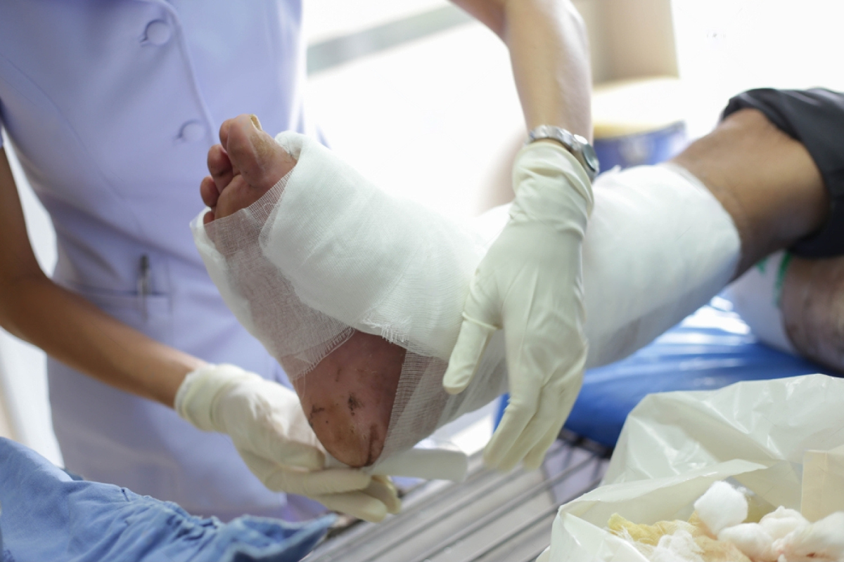 Orthopedic Treatment for Infected Wounds Effective Solutions for Healing and Prevention