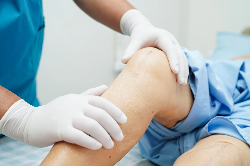Orthopedic Surgeon Quezon City Your Guide to Expert Bone and Joint Care