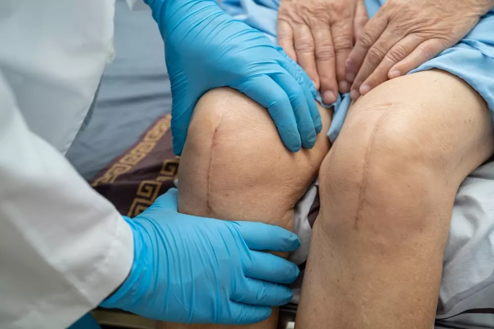 Total Knee Replacement What You Need to Know About Restoring Mobility and Relieving Pain
